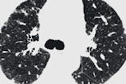 2014 02 18 12 42 55 600 2014 02 19 Lancet 800 20140219164758