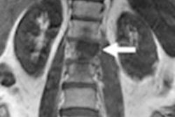 2014 02 19 13 21 54 853 Pet Ct Mri Eiber 01 500 20140219202243