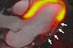2014 03 03 17 53 20 74 2014 03 06 Hybrid Cardiac Imaging 200