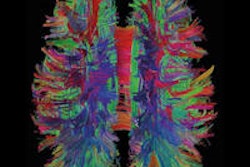 2014 03 08 12 12 20 287 2014 03 08 Mri Brain 200