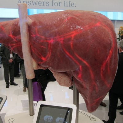 This gigantic liver illustrates FreezeIt, an algorithm from Siemens that allows MRI scanning of the liver without patient breath-holds.