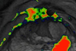 2014 03 18 10 28 35 967 2014 03 18 Cad Mri Prostate 200