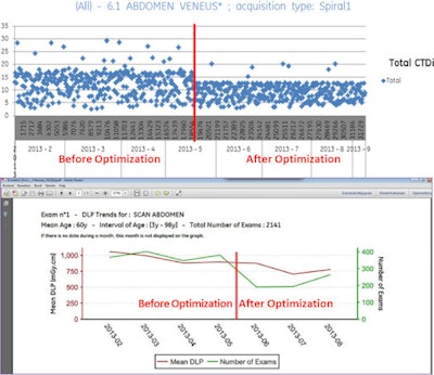 After optimization, fewer outliers are seen and the majority of studies have now a CTDI less than 14, and this was 18 to 19 before (top). Before optimization, an average dose length product (DLP) of 1000 mGy·cm was used. Six months later and after optimization, DLP fell by 25% to 750 mGy·cm (bottom), as shown by the red line.