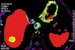2014 03 20 10 46 22 142 2014 03 21 C Tperfusion Kantarci Thumb