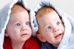 2014 03 25 12 13 31 848 Blue Eyed Twins 200