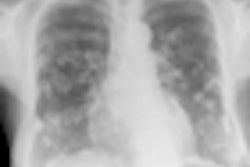 2012 10 22 09 04 23 179 Digital Xray 70