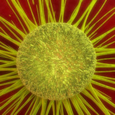 2014 03 31 13 43 37 936 Cancer Cell Yellow 200