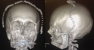 X-rays of Stephen Power's skull.