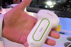2014 04 03 15 33 32 622 Philips Visiq