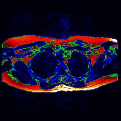 2014 04 17 23 20 09 947 2014 04 18 Mri Brown Fat