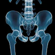 2014 05 05 13 39 25 584 Pelvis 200