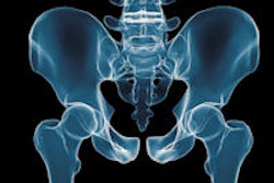 2014 05 05 13 39 25 584 Pelvis 200