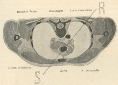 Fig. 4: The early use of a cross-sectional image.