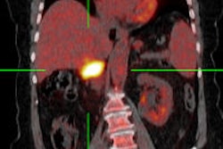 2014 05 15 12 34 27 618 2014 05 16 Pet Ct 16may14 Thumb