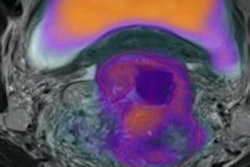 2014 05 29 09 17 13 802 2014 05 29 Molecular Thumb