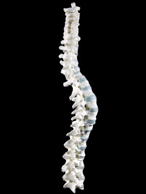 A 3D model of the spine with replica polymer vertebrae was created by laser sintering. All images copyright of the University of Leicester.
