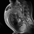2012 01 12 13 10 50 17 2012 01 Xx Fetal Mri 20140612170519
