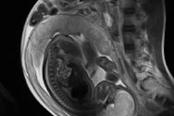 2012 01 12 13 10 50 17 2012 01 Xx Fetal Mri 20140612170519