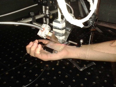 Bidirectional optoacoustic imaging of a volunteer's hand using the scanning prototype.