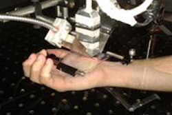 2014 06 12 13 37 47 496 2014 06 13 Medphysweb Imaging Of Palm 20140613150309