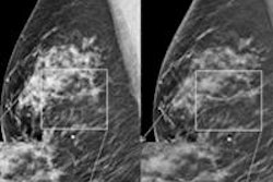 2014 06 16 15 07 14 493 Skaane Figure2 400 20140616220735