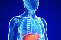 2014 06 23 12 47 37 391 Liver Anatomy 200