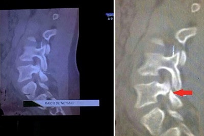 This image has gained much attention after being shown on Brazilian TV, but its authenticity has been questioned.