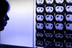 2014 07 08 12 39 48 941 Doc Xray 200