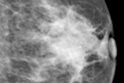 2014 07 10 14 52 55 19 2012 12 12 Ce Mammo Thumb 200