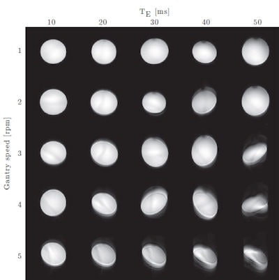 Imaging during gantry rotation revealed increasing distortion as gantry speed and echo time increased.