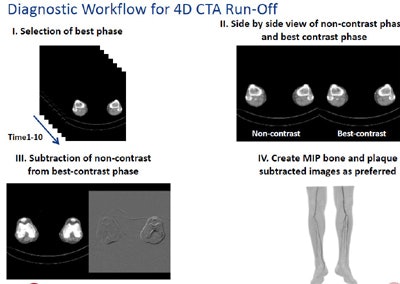 Sending only MIPs to the PACS saves storage space and reading time.