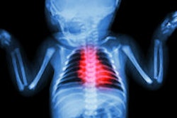 2014 07 23 12 38 52 944 Infant X Ray 200