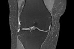 2014 07 30 12 31 33 80 2014 07 31 Knee Mri Thumbnail