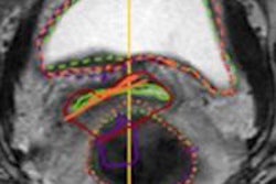 2014 07 31 13 56 13 601 2014 08 01 Medphysweb Brachy Registration 20140801150434