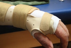 2014 08 20 09 02 56 209 Wrist Brace 200