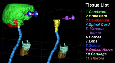 Segmentation reveals multiple organs in the head and neck. All images courtesy of Wiro Niessen, PhD.