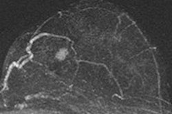 2014 08 25 15 36 32 199 2014 08 26 Kuhl Mri Thumb