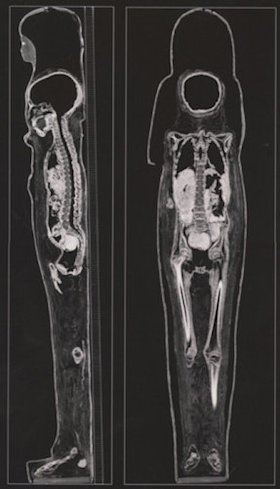 Longitudinal CT sections of mummy in its cartonnage case.