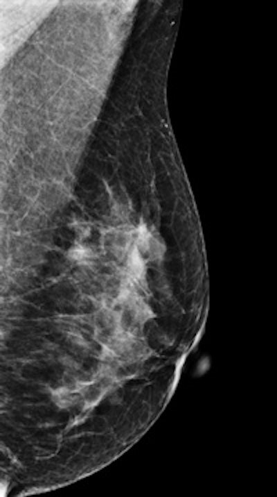 2014 09 12 13 05 40 669 2014 09 10 Dbt Pic1