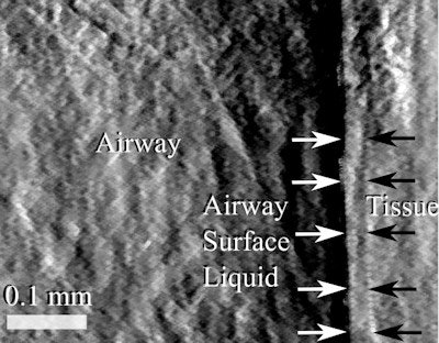 Single-grid-based phase contrast x-ray imaging can visualize the airway, surface liquids, and underlying tissues in mice.