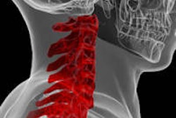 2014 09 29 13 34 28 239 Cervical X Ray 200