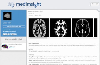 2014 10 03 11 15 01 922 2014 10 06 Medim Sight Gonzales Lmbaio Brainsegment2 350