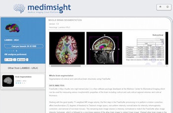 2014 10 03 11 15 06 225 2014 10 06 Medim Sight Gonzales Lmbaio Brainsegment 350
