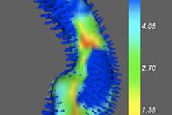 2014 10 03 11 15 08 32 2014 10 06 Medim Sight Gonzales Hippocampal Volume2 20141003181747