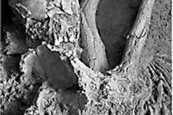 2014 10 06 09 53 17 135 2014 10 06 Paleo Child Qafzeh11 Figure5 20141006190457