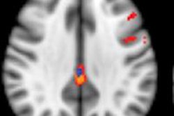 2014 10 08 12 21 42 249 Asl Mri Cortex Larger 400 20141008192208