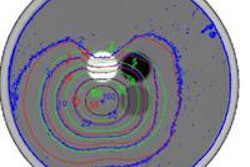 2014 10 09 11 11 18 783 2014 10 10 Medphysweb Isodose Fig3a 20141009182058