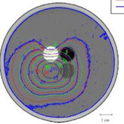 2014 10 09 11 11 18 783 2014 10 10 Medphysweb Isodose Fig3a 20141009182058