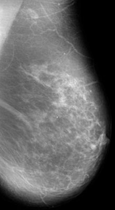 2014 10 13 16 12 26 486 2014 10 14 Early Detection Pic1