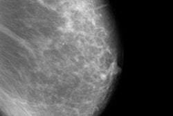 2014 10 13 16 18 47 143 2014 10 14 Early Detection Thumb